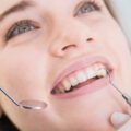 Οι οδοντικές όψεις απαιτούν πολλή συντήρηση;